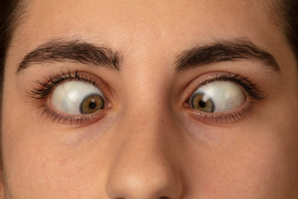 istock A close-up of a  Squint woman 1398291973