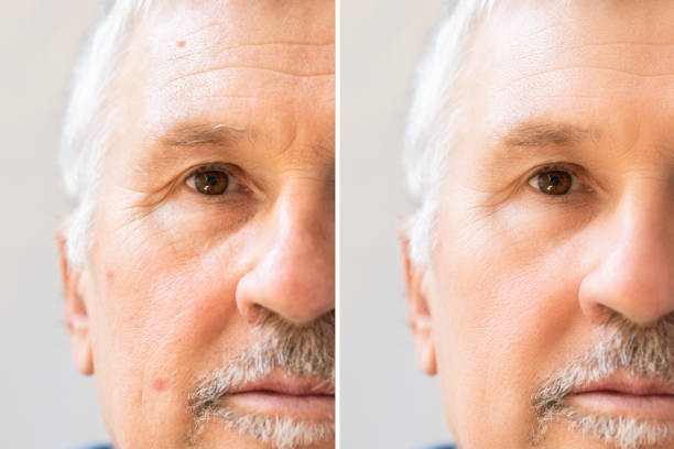 istock Man With Before And After Rejuvenation 1398412848
