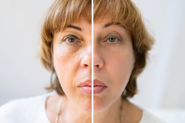 istock Woman With Before And After Rejuvenation 1398412855