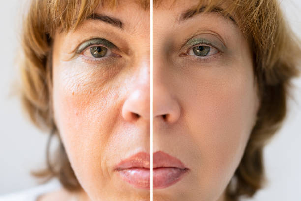 istock Woman With Before And After Rejuvenation 1398412870