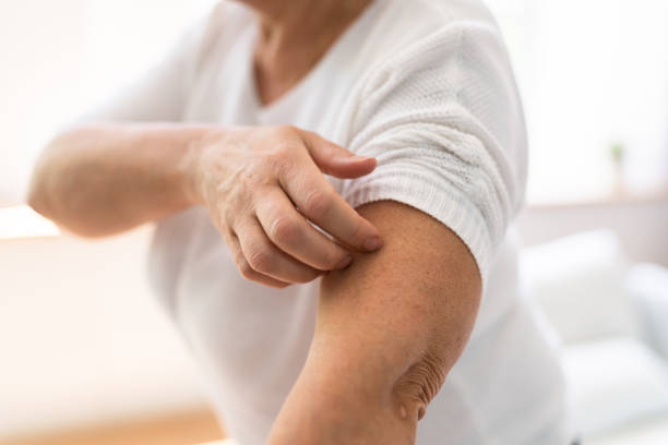 istock Woman Scratching Itching Body Skin 1398413006