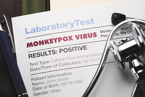 Monkeypox virus test results document with stethoscope
