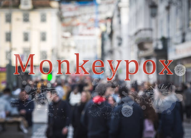 Monkeypox. virus infection stock photo