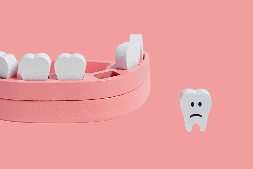 Teeth loss concept. Wooden jaw model with missing or extracted tooth with sad emoji on pink background. Poor oral hygiene, dental problems concept. High quality photo