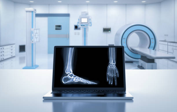Hospital radiology room with computer notebook display x-ray film stock photo