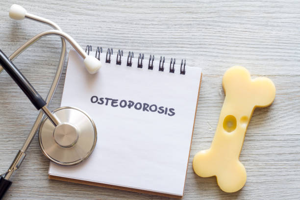 istock Bone shaped cheese, notebook and stethoscope, concept osteoporosis 1398595479