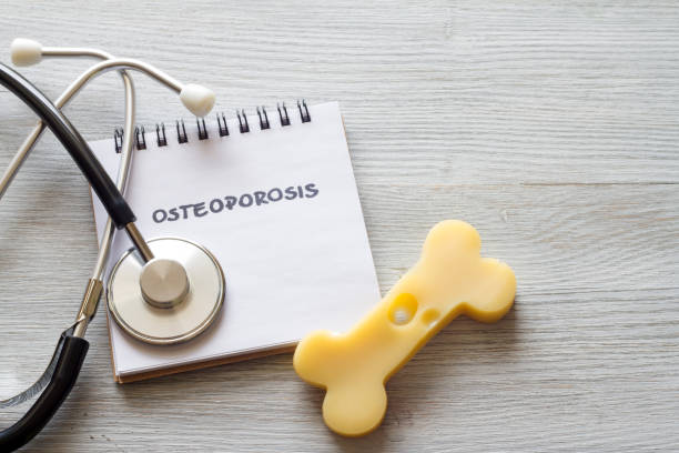 queso en forma de hueso, cuaderno y estetoscopio, concepto osteoporosis - brittlebush fotografías e imágenes de stock