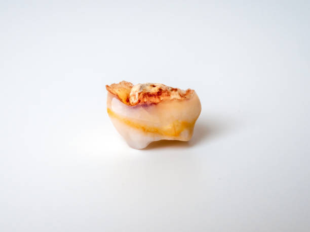 istock Close-up of a pulled out milk tooth isolated on white background 1398597770