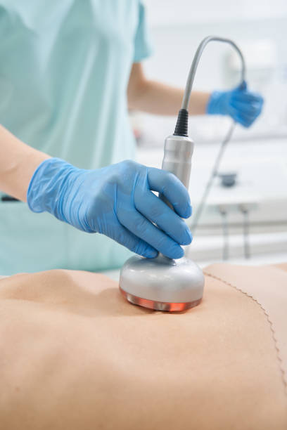 istock Hand holding radiofrequency beauty gadget on stomach 1398638859