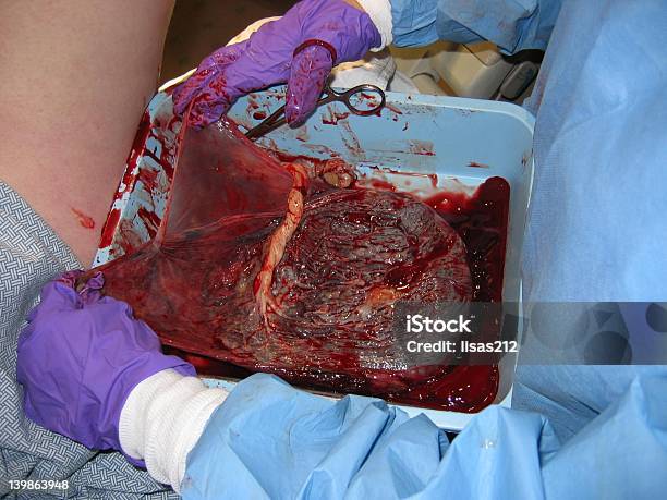 Mmmm Placenta - Fotografie stock e altre immagini di Camice chirurgico - Camice chirurgico, Camice da medico, Close-up