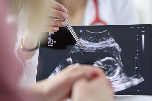 Doctor shows pregnant woman an ultrasound scan of fetus. Medical examination during pregnancy concept