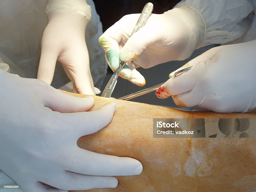 Mãos de cirurgiões - Royalty-free Acidentados Foto de stock