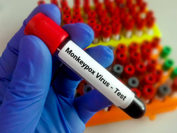 istock Blood sample for Monkeypox virus test. It is also known as the Moneypox virus, a double-stranded DNA virus and member of Poxviridae family. 1398654358