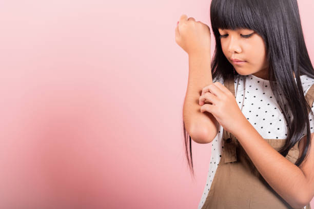 Asian little kid 10 years old scratching itch arm from a mosquito bite stock photo