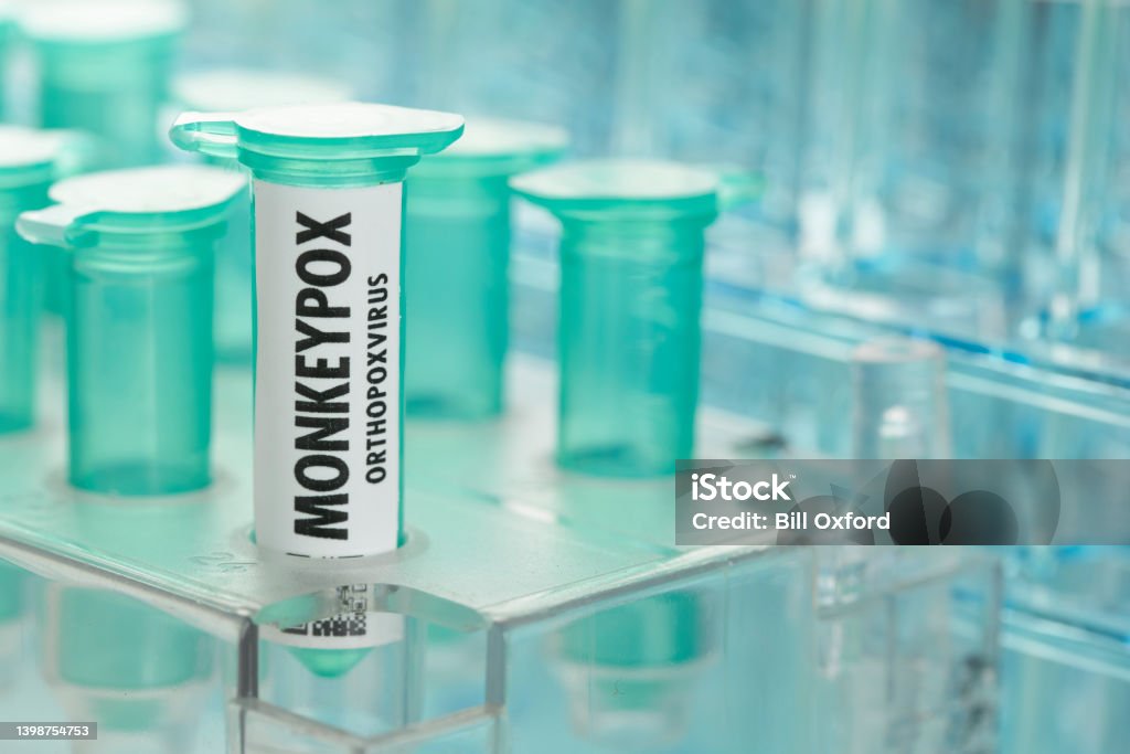 Monkeypox Lab Specimen Types Monkeypox Virus In Laboratory Vials And Test Tubes Stock Photo ...