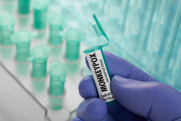 istock Monkeypox virus in laboratory vials. pipette and test tubes 1398754766