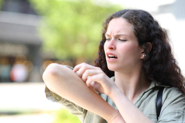 Stressed woman scratching arm in the street Stressed woman scratching arm in the street bug bite stock pictures, royalty-free photos & images