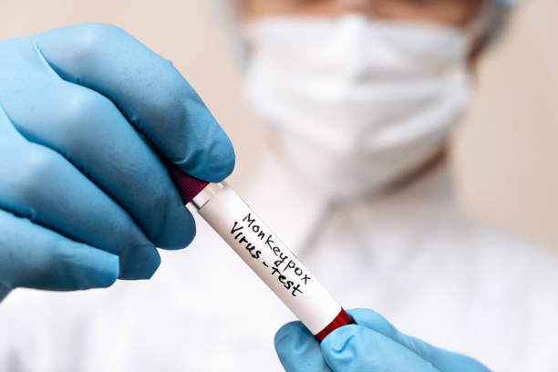 A medical worker holds a test tube with Monkeypox virus infected blood sample in his hands,hands in gloves close-up.Epidemic of smallpox monkeys in Europe and the USA A medical worker holds a test tube with Monkeypox virus infected blood sample in his hands,hands in gloves close-up.Epidemic of smallpox monkeys in Europe and the USA. mpox stock pictures, royalty-free photos & images