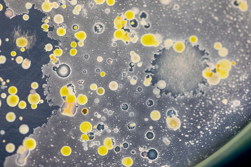 Microbiology agar plate with yeast culture on grey background.