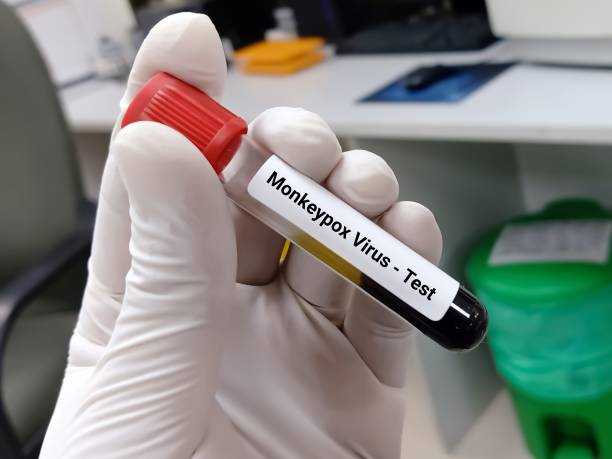Scientist hold blood sample for Monkeypox virus test. Scientist hold blood sample for Monkeypox virus test. A member of the Orthopoxvirus genus in the family Poxviridae. animal internal organ photos stock pictures, royalty-free photos & images