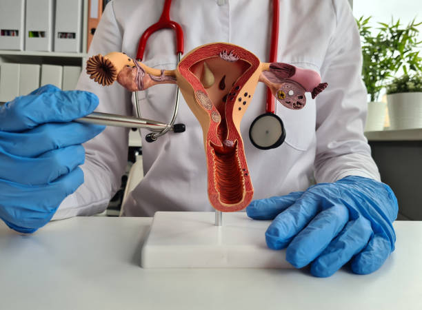istock Anatomical model of uterus with pathologies closeup 1398932867