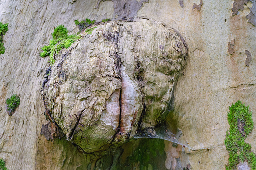 tumor on tree trunk, with cleft crack in middle, close-up, overgrown with moss. Sycamore diseases