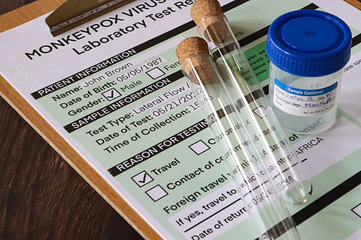 Stock photo showing close-up elevated view of completed medical form for Monkeypox (Poxviridae) virus test.