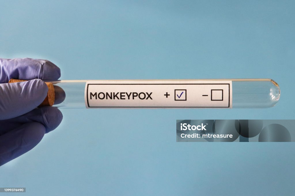 Close-up image of Monkeypox (Poxviridae) lab test labelled glass test tube held in latex gloved hand, blue background, elevated view Stock photo showing close-up, elevated view of unrecognisable person's gloved hand holding lab test labelled glass test tube for Monkeypox (Poxviridae) virus test. Mpox Stock Photo