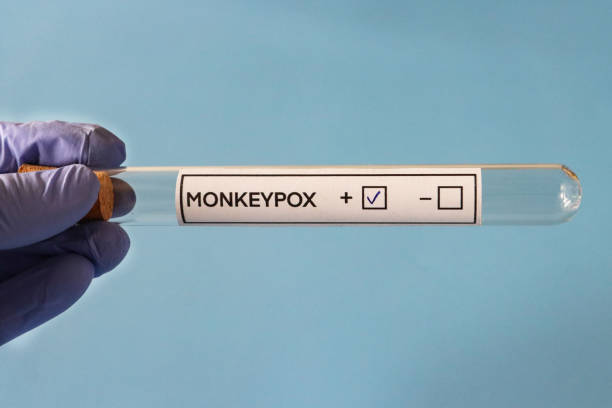 Close-up image of Monkeypox (Poxviridae) lab test labelled glass test tube held in latex gloved hand, blue background, elevated view stock photo