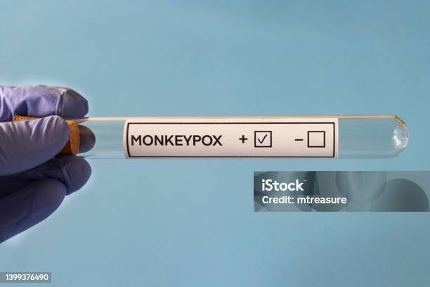 Closeup Image Of Monkeypox Lab Test Labelled Glass Test Tube Held In Latex Gloved Hand Blue Background Elevated View Stock Photo - Download Image Now