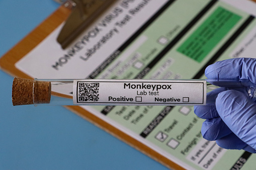 Stock photo showing close-up, elevated view of unrecognisable person's gloved hand holding lab test labelled glass test tube over completed medical form for Monkeypox (Poxviridae) virus test.
