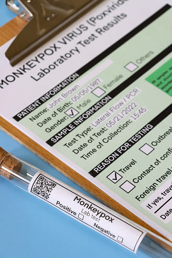 Stock photo showing close-up, elevated view of lab test labelled glass test tube besides completed medical form for Monkeypox (Poxviridae) virus test.