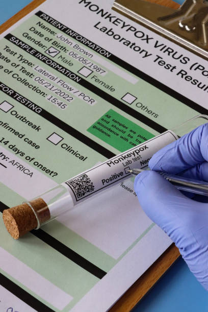 Stock photo showing close-up, elevated view of unrecognisable person's gloved hand holding ballpoint pen to complete label on lab test glass test tube with medical form for Monkeypox (Poxviridae) virus test. imagen de primer plano del bolígrafo sostenido en la mano enguantada de látex para completar la etiqueta en el tubo de ensayo de vidrio de prueba de laboratorio, portapapeles con la forma de resultados de la prueba médica del virus monkeypox (poxviridae