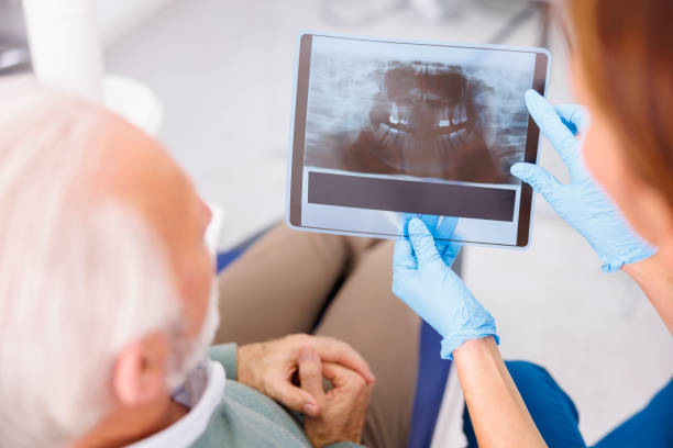 환자에게 턱 엑스레이를 보여주는 치과 의사 - dental equipment chair dentist office dentists chair 뉴스 사진 이미지