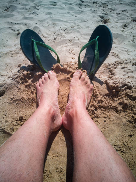 istock Sunburn on the feet with flip flops, vertical view from above 1399443503
