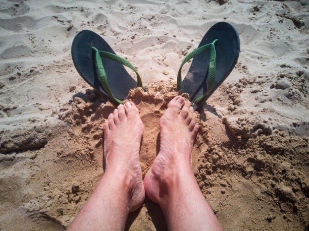 istock Sunburn on the feet with flip flops, view from above 1399443515