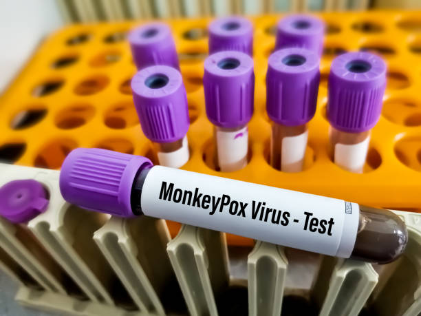 échantillon de sang isolé pour le test du virus de l’orthopoxvirose simienne. - virus pox photos et images de collection