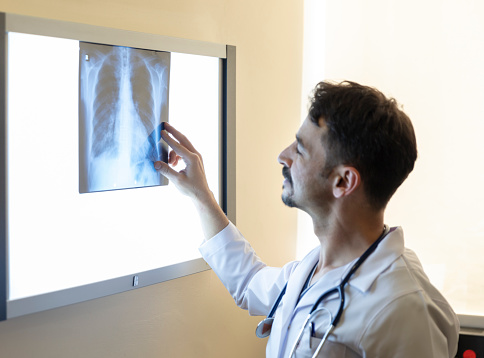 Doctor looking at x-ray of a lung