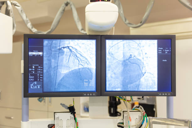 View of modern medical X-ray operating room (cath lab) View of modern medical X-ray operating room (cath lab) catheter stock pictures, royalty-free photos & images