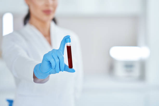 Woman holding test tube with blood and mixing machine stock photo