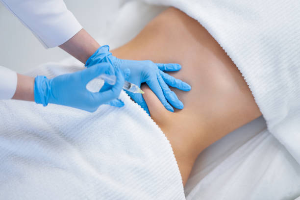 Picture of lipolysis treatment on different parts of woman body stock photo