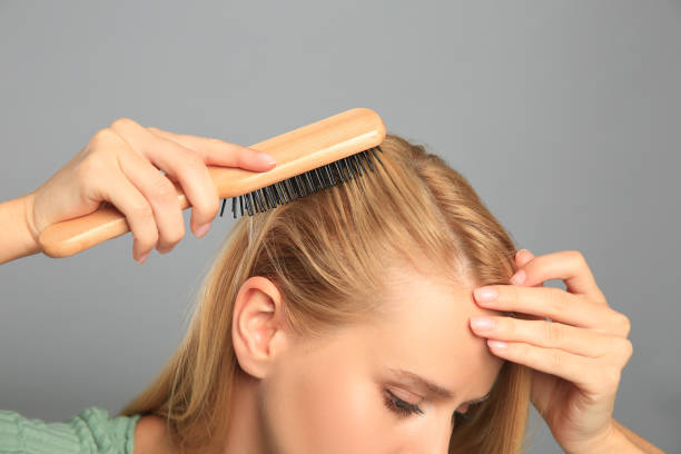 Woman with hair loss problem on grey background, closeup. Trichology treatment Woman with hair loss problem on grey background, closeup. Trichology treatment woman hairline stock pictures, royalty-free photos & images