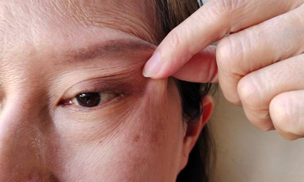 Squeeze the flabbiness and blemish beside the eyelid. Portrait showing the fingers squeezing flabbiness adipose hanging skin beside the eyelid, problem wrinkle and blemish under the eye of the woman, concept health care. asian eyebrows stock pictures, royalty-free photos & images