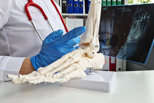 Trauma surgeon evaluates x-rays of legs. Skeleton foot symptoms and treatment concept