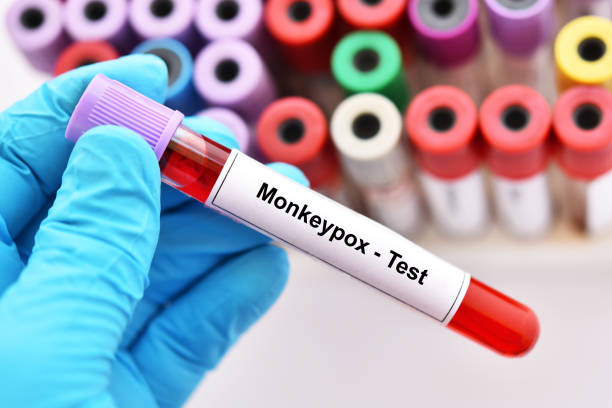 Monkeypox Testing Video 450+ Patient Monkey Stock Photos, Pictures & Royalty-Free Images - iStock