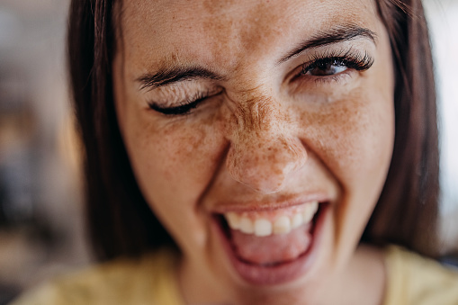 The freckled woman grimaces