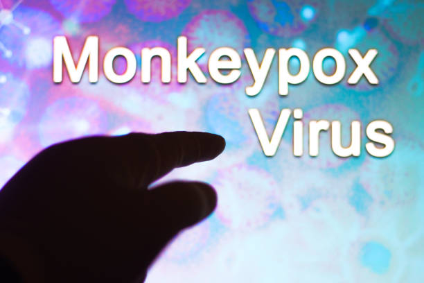 istock A human hand with the word Monkeypox virus in the background. Monkeypox is a viral disease that occurs mainly in central and western Africa. 1399651317