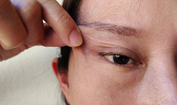 istock Holding the flabbiness and wrinkle around the eye. 1399680478