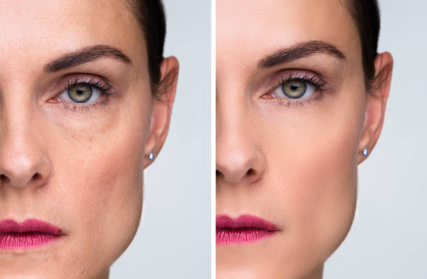 istock Woman With Before And After Rejuvenation 1399683178