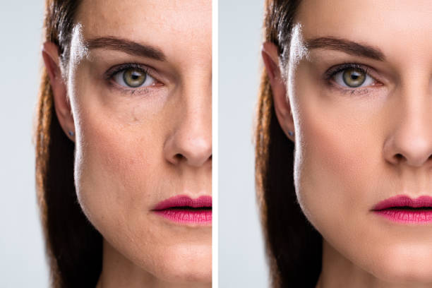 istock Woman With Before And After Rejuvenation 1399683185